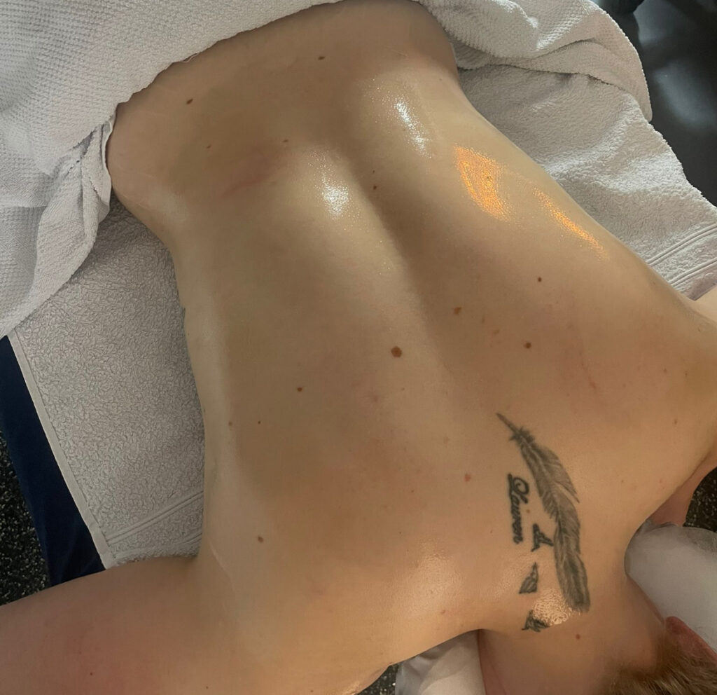 cupping naturelse